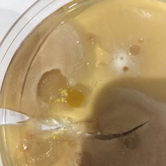 Anyone good at identifying germs on Agar plates?