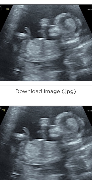 Boy or girl?Found out today?