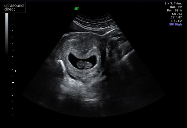 Early Oct babies part 2!