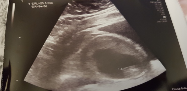 Early Oct babies part 2!