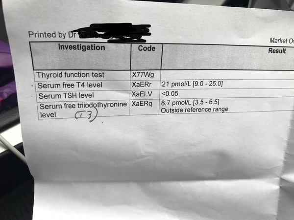 hypothyroidism - what are the full tests ?