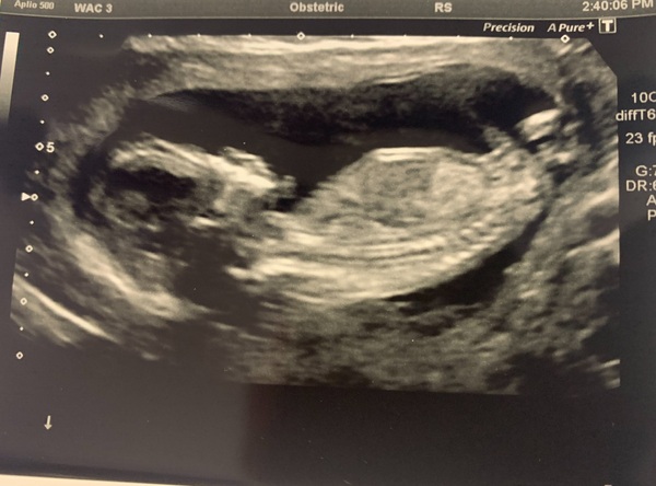 Any gender guesses?