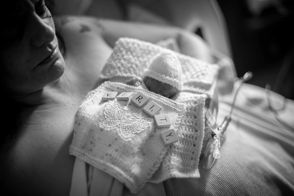 Colposcopy at 17w4d.