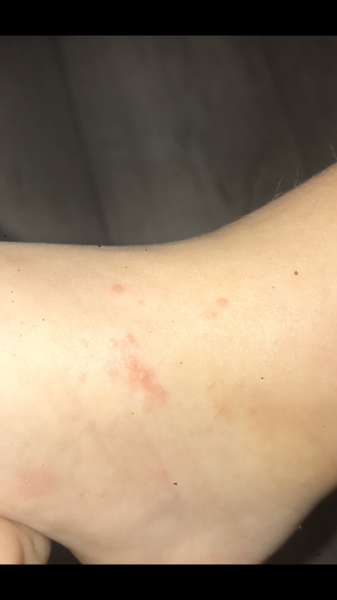 Anyone have family in dermatology ?