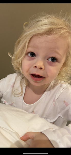 Worried about toddler DD (photos attached)