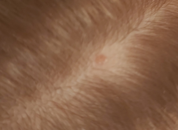To be really worried about spot on DD's scalp?