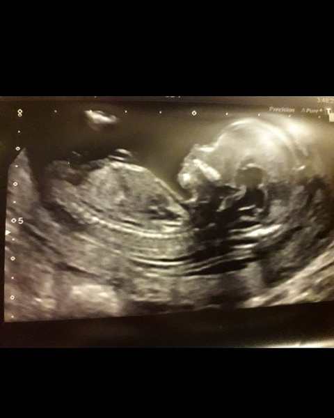 Girl or boy guesses please :) I have no clue!