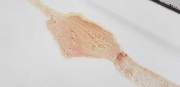 Blood trails in the shower?!