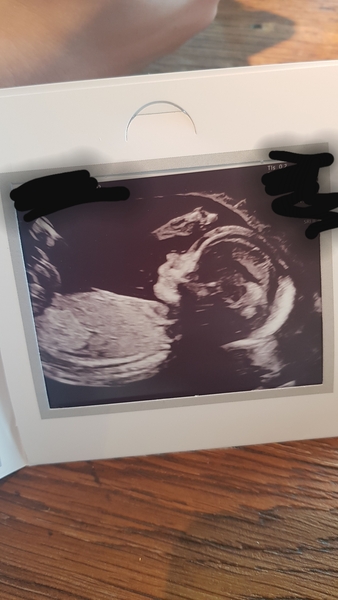 Late July Due Date #2