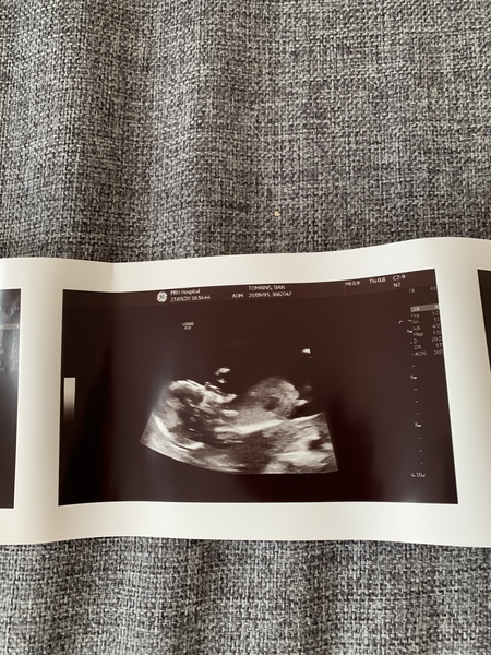 Early Oct babies part 2!