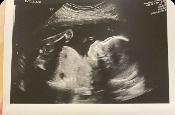 Anyone due August 2020 pt II