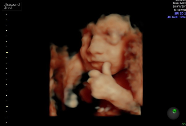Due June 2020: Thread 4