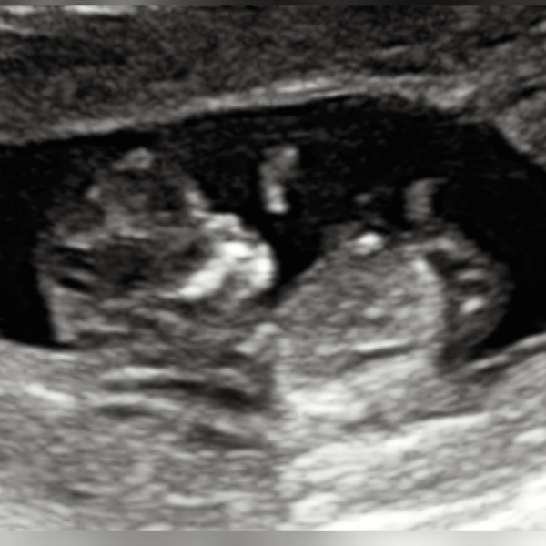 Any gender guesses?