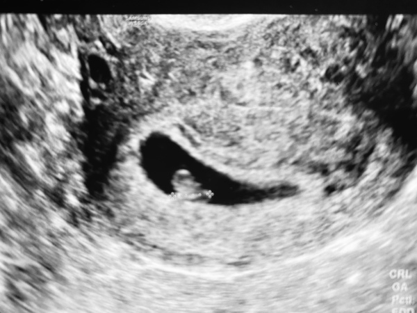 Dec19/Jan20 IVF Graduates