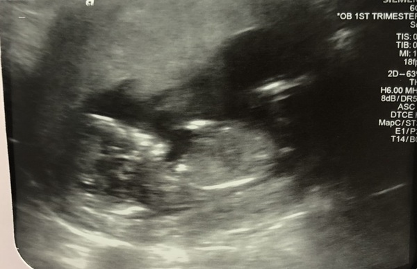 Girl or Boy? What do we think?