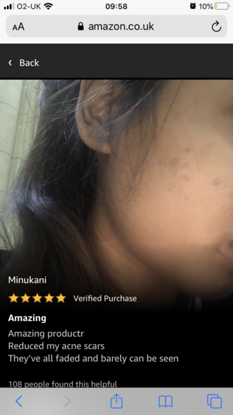 Son’s acne/scaring ... any at home light therapy that’s helpful?