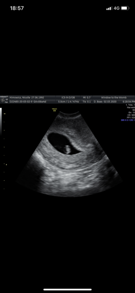 Early Private Scan??