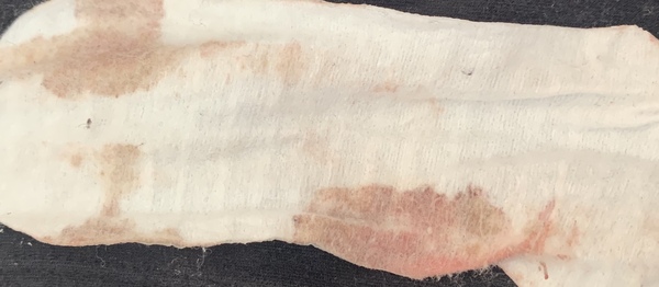 TMI , 3 weeks pregnant is this a miscarriage ?