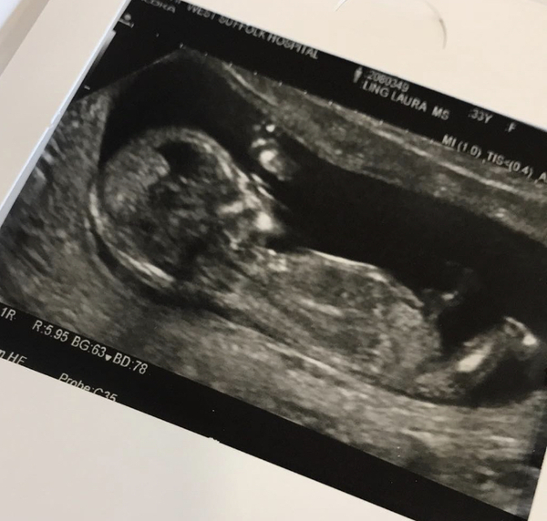 New thread for the crazy gang - part 3!