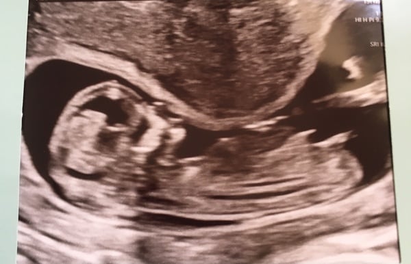 Rainbow baby boy or girl guesses (just for fun)