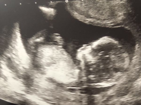 Early Oct babies part 3!