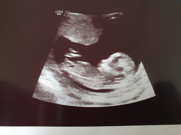 Early Oct babies part 3!