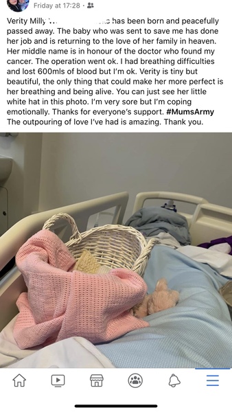 Colposcopy at 17w4d.