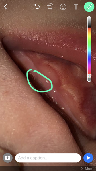 Is this my baby’s first tooth??