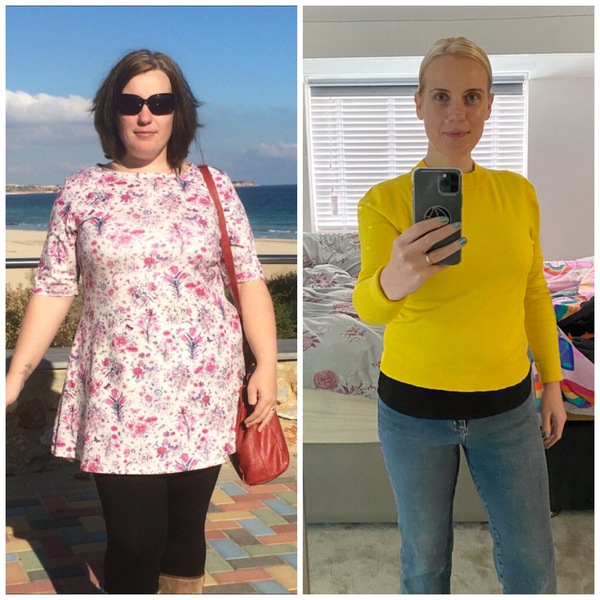 Weight loss surgery.
