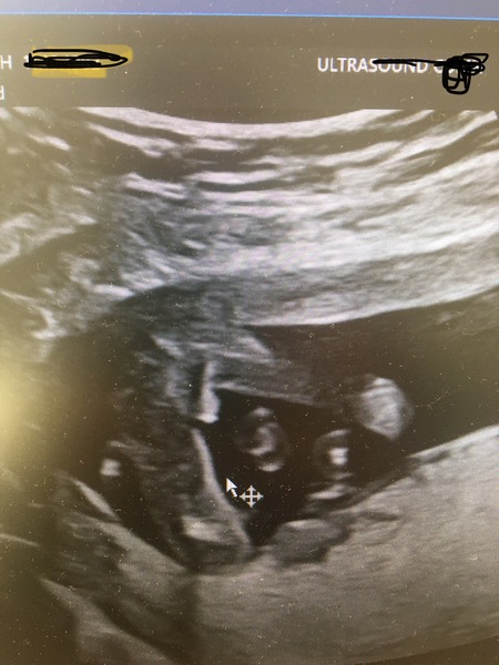 Potty shot 16 weeks guesses please?