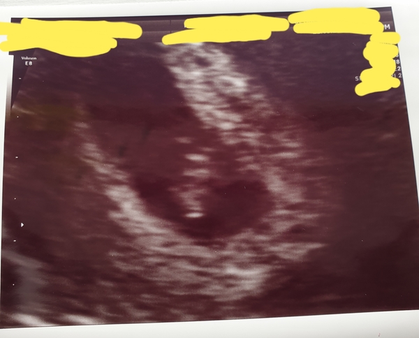 November 2020 Babies - thread 2