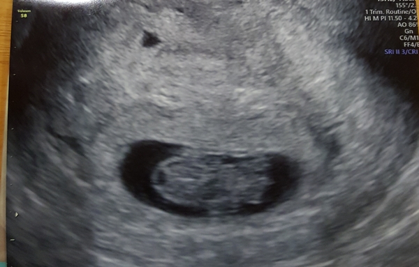 Early Oct babies part 2!