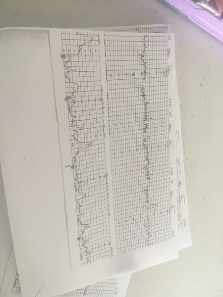 Can anyone with a medical background read these labour traces