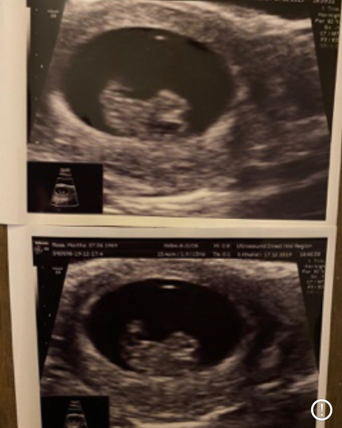 Does this look ok for a 9 week scan?