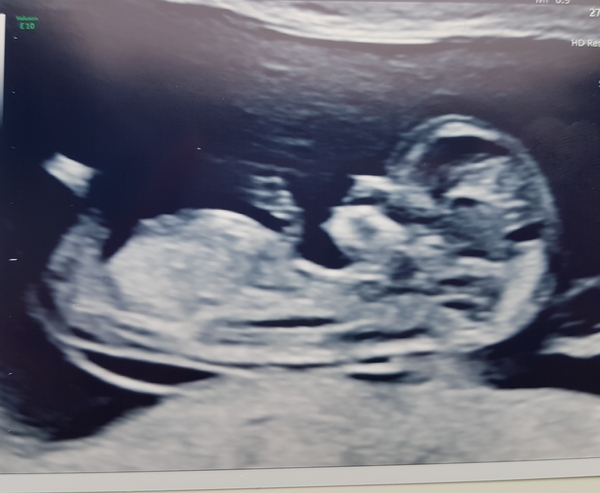 Just for fun....nub theory 12 weeks