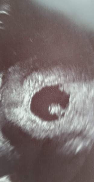 Dec19/Jan20 IVF Graduates