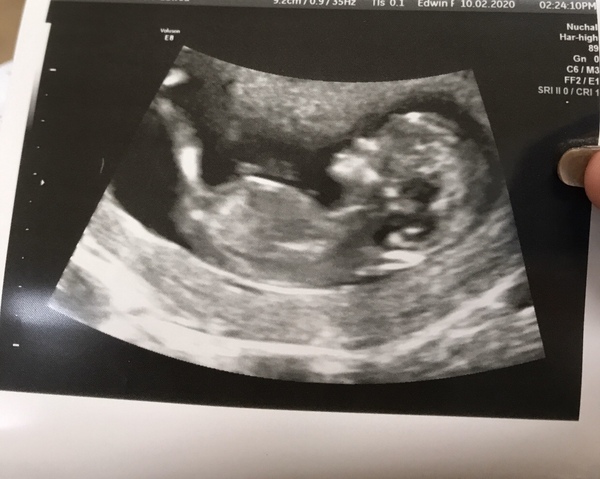 Girl or Boy?