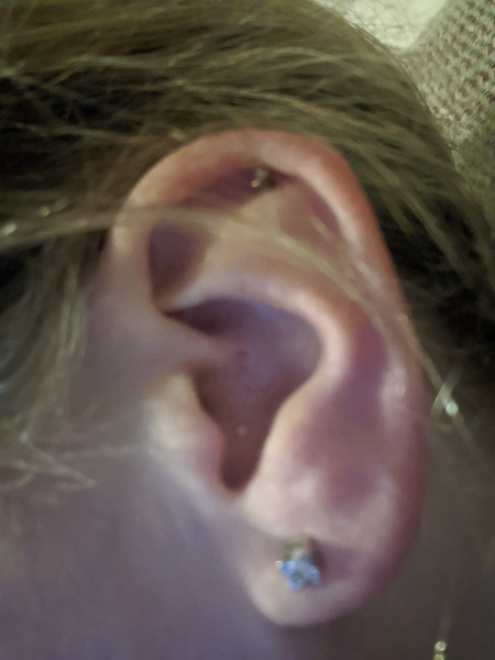 What's this spot on my ear?