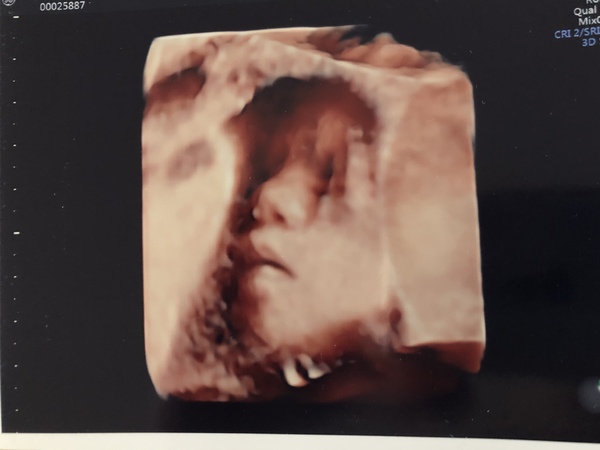 Due June 2020: Thread 5