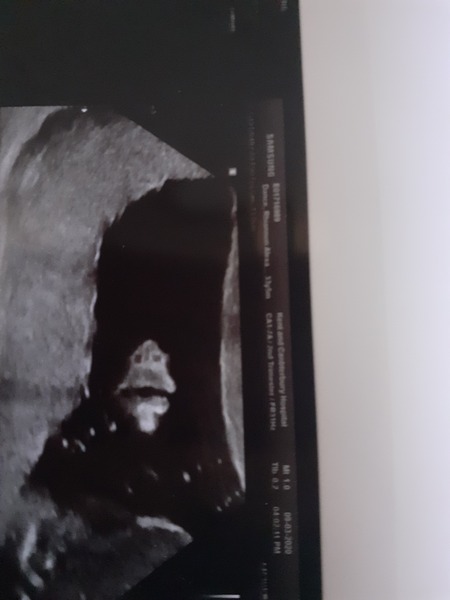 It's a boy!