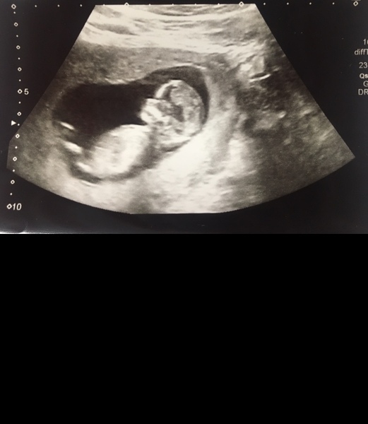 Any guesses on boy or girl?