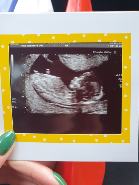 September 2020 BABIES