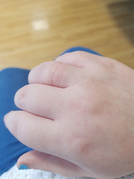 I'm going to have to go to hospital aren't I?