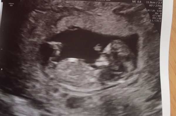 Early Oct babies part 3!