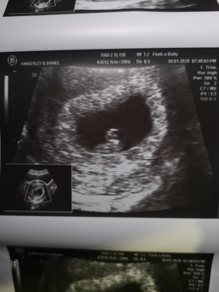 Early Private Scan??