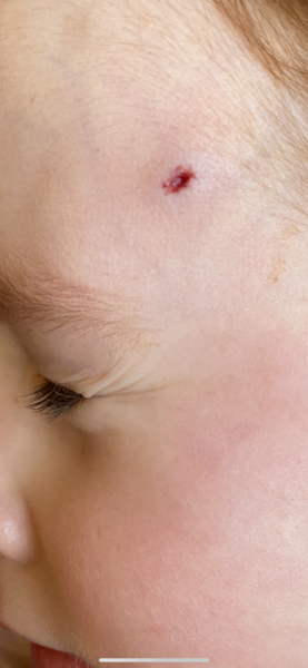 *Traffic Posting* Child hit head and worried :(