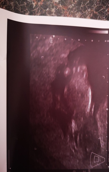 Overweight scan pic.....