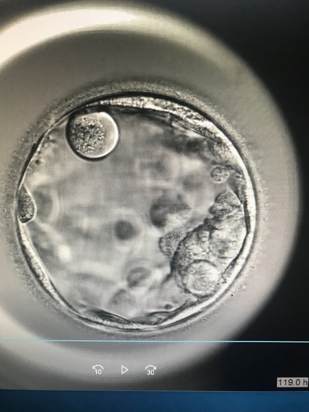 The little embie that could - IVF pregnancy support