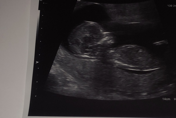Early Oct babies part 2!