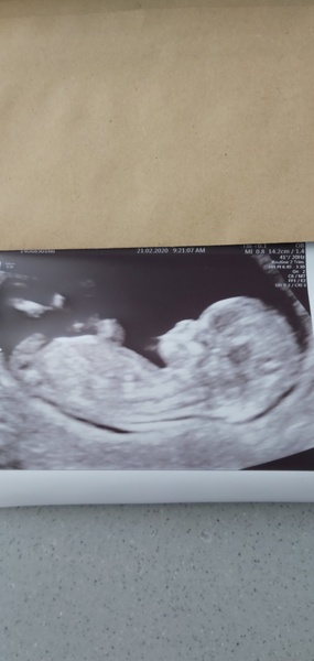 Boy or girl? 💙❤